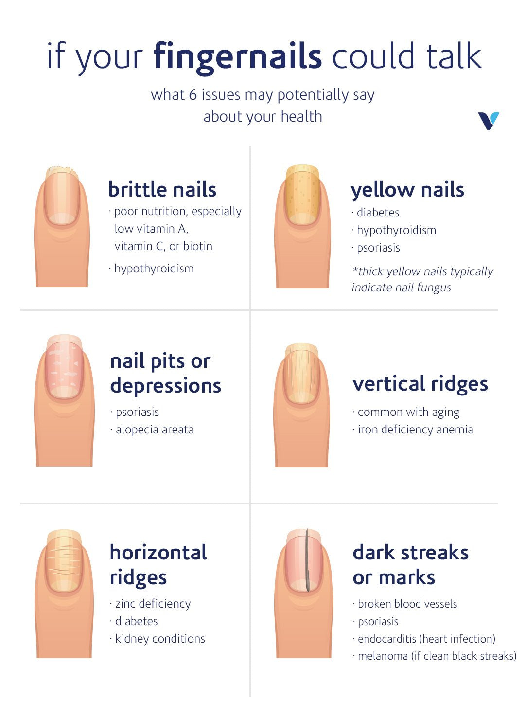 What Your NAILS CAN TELL YOU ABOUT YOUR HEALTH